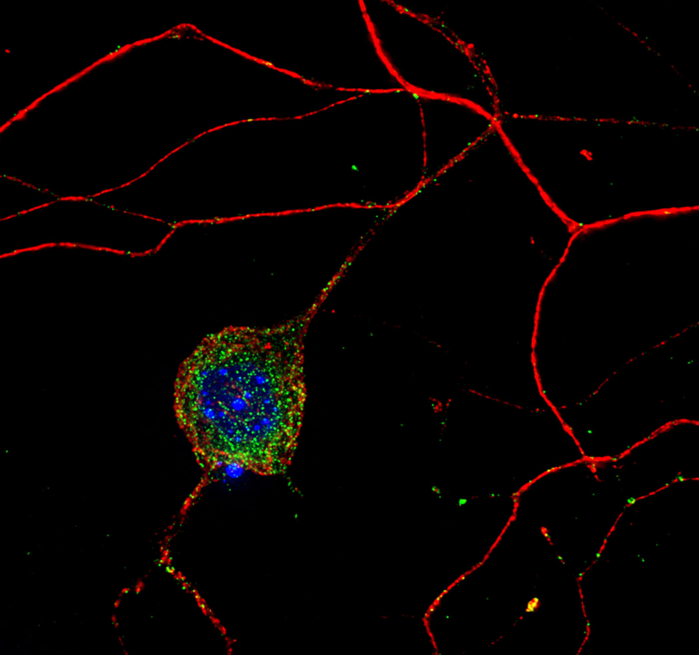 Fluorescence microscopy of a dorsal root ganglion neurone
